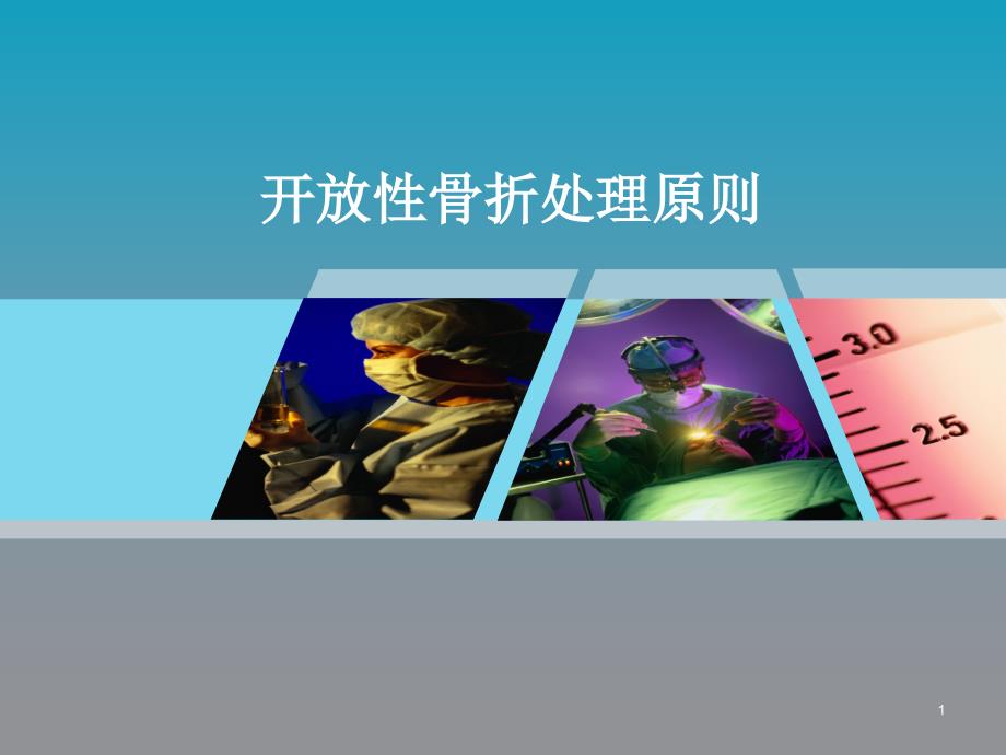 开放性骨折处理PPT幻灯片.ppt_第1页