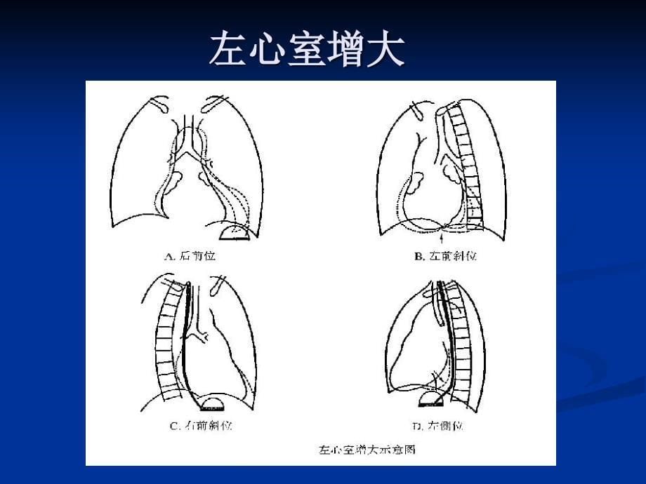 心脏大血管基本病变pp发t课件_第5页