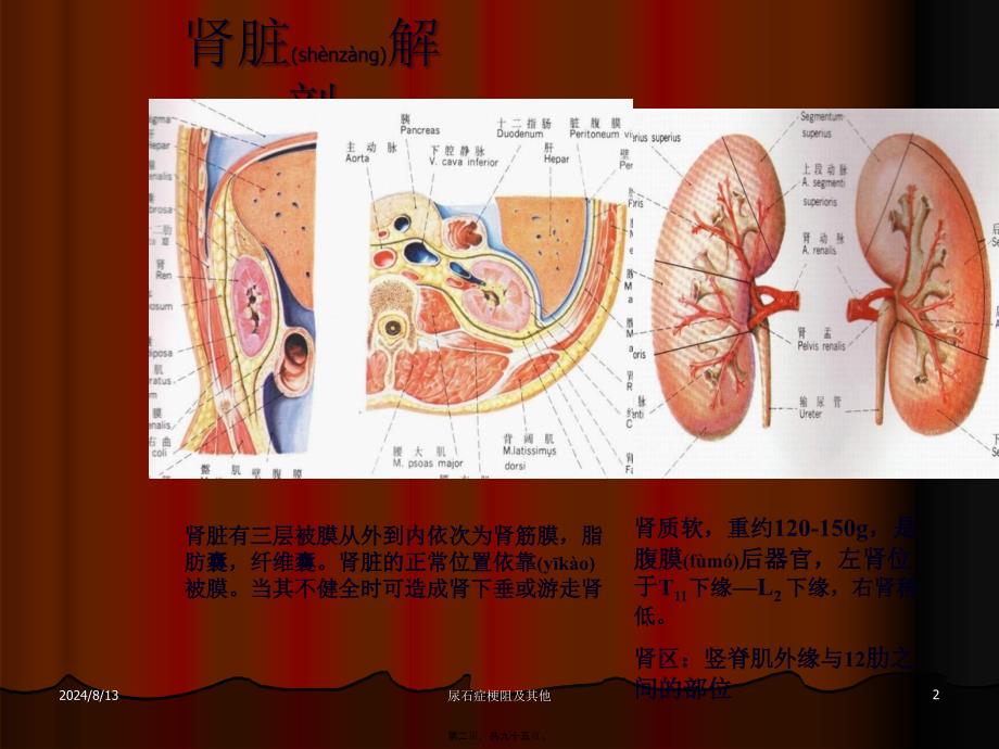 尿石症梗阻及其他课件_第2页