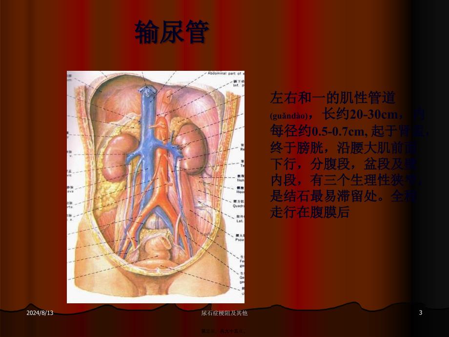 尿石症梗阻及其他课件_第3页