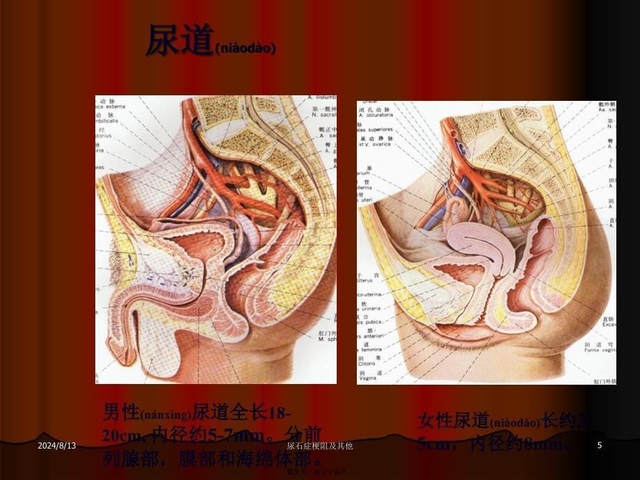 尿石症梗阻及其他课件_第5页