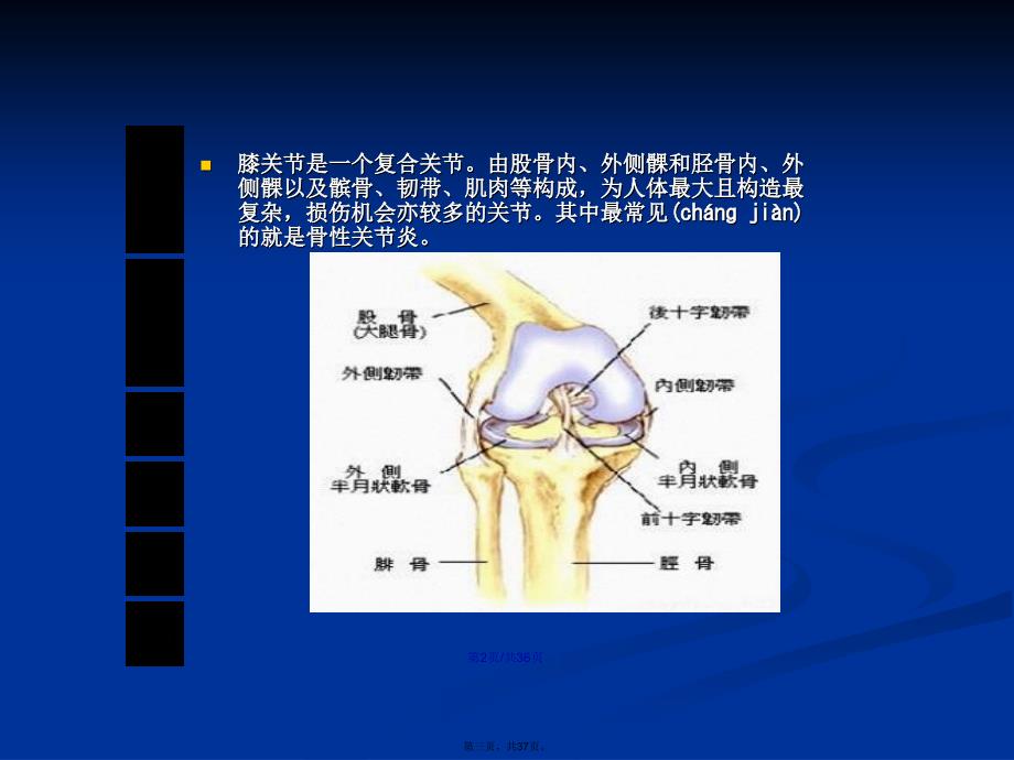 人工膝关节置换术手术配合pptPPT学习教案_第3页