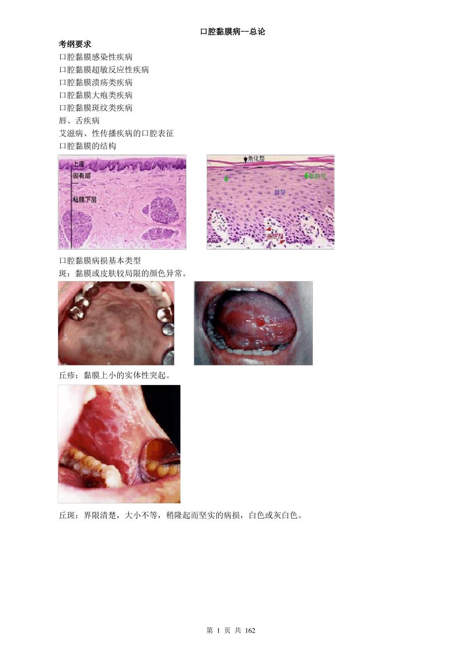 口腔内科学(口腔黏膜病牙周病等)讲义_第3页