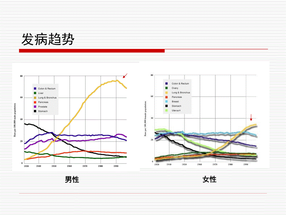 肺癌早期诊断李凡_第2页