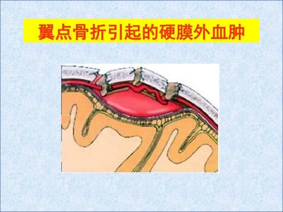 颅的前面和侧面观_第5页