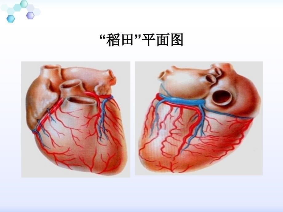 冠心病健康宣教_第5页