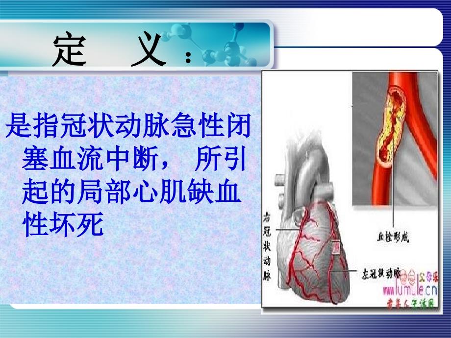 新收急性心肌梗死抢救的配合与护理_第4页