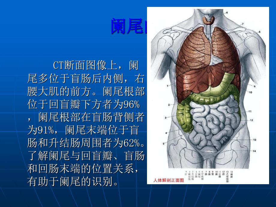 急性阑尾炎的CT诊断_第4页