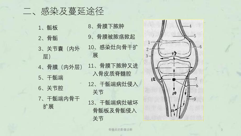 骨髓炎的影像诊断课件_第3页