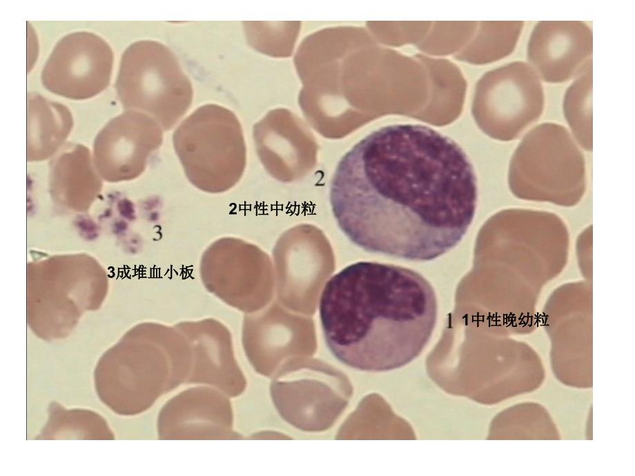 血液学细胞形态学复习附图片_第4页