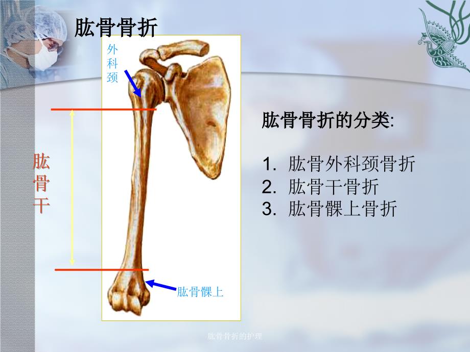 肱骨骨折的护理_第3页