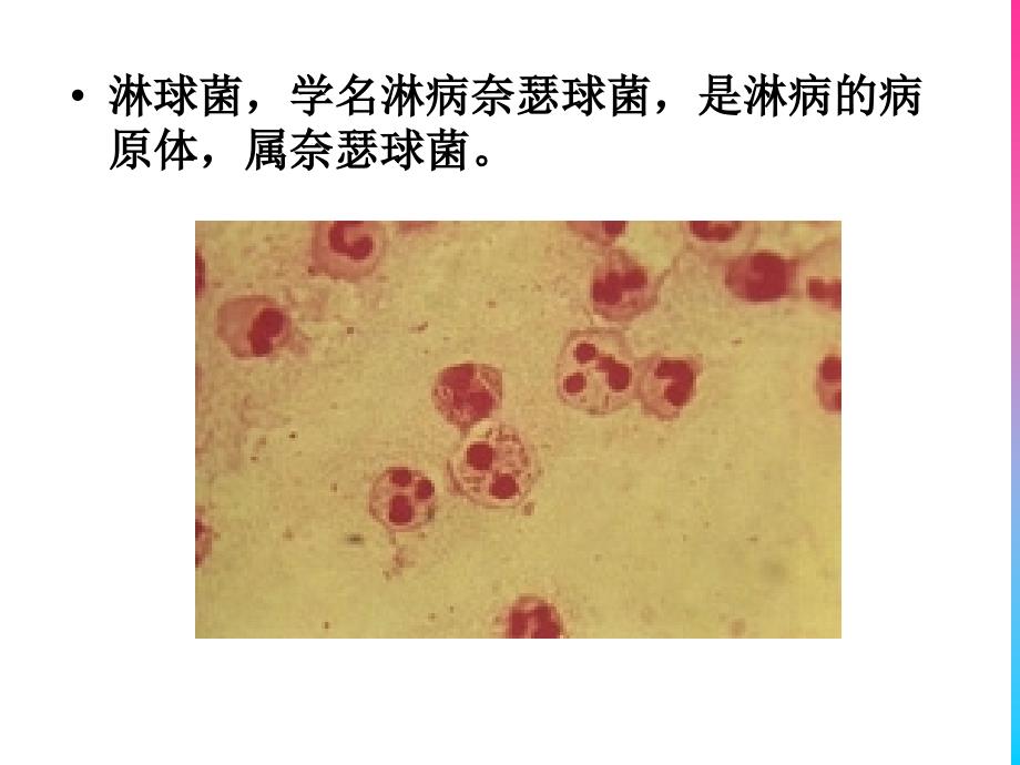 淋球菌适宜临床检验技术介绍_第3页