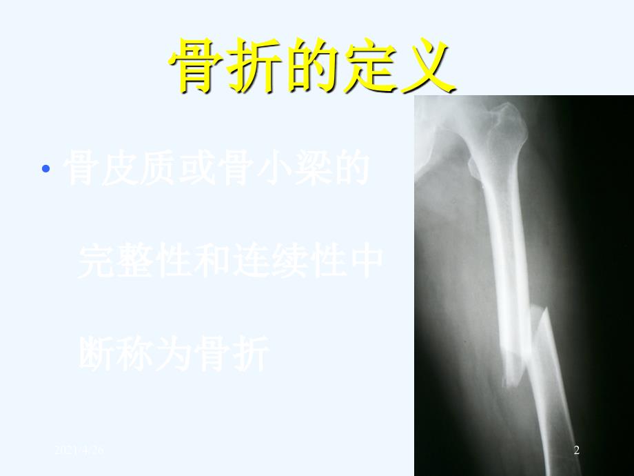 骨折概论、上肢骨折（142页）_第2页