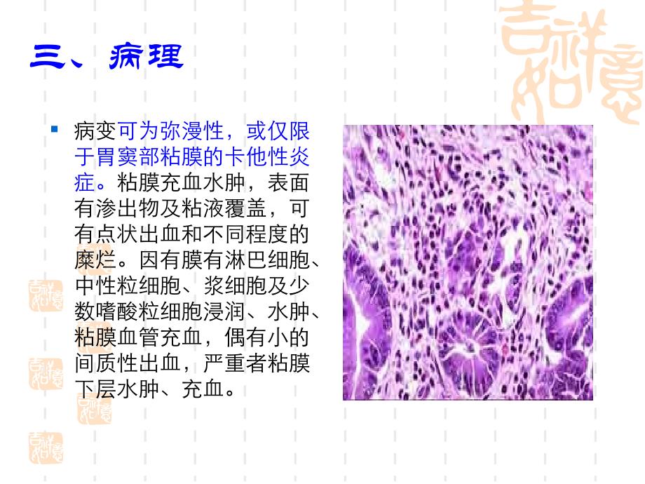 常见疾病的社区照顾急性胃炎_第4页