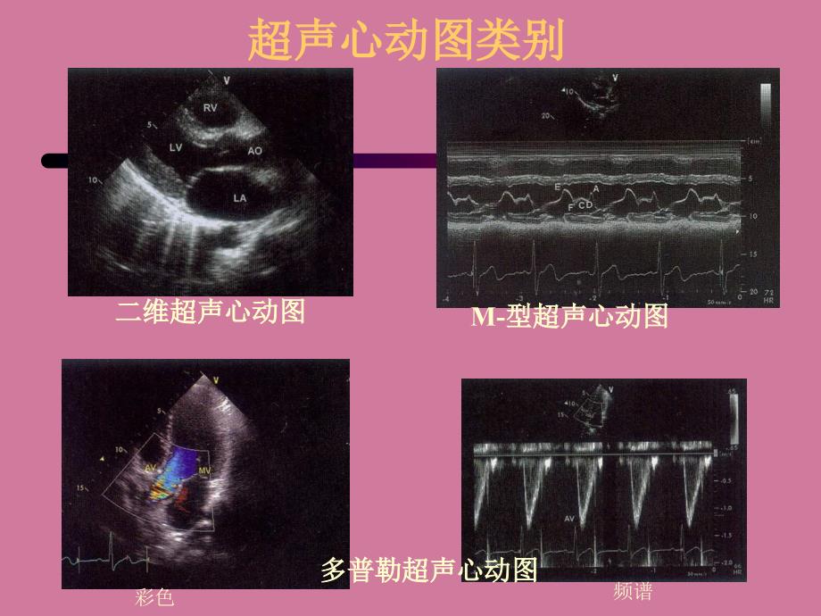 心脏超声心动图基础篇ppt课件_第3页