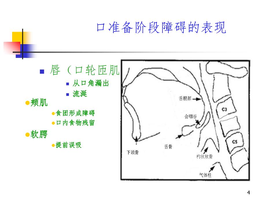 脑卒中后吞咽困难PPT课件_第4页