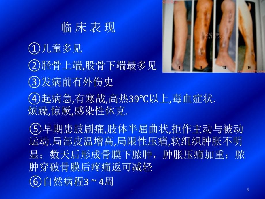 (医学课件)骨与关节感染最新ppt演示课件_第5页