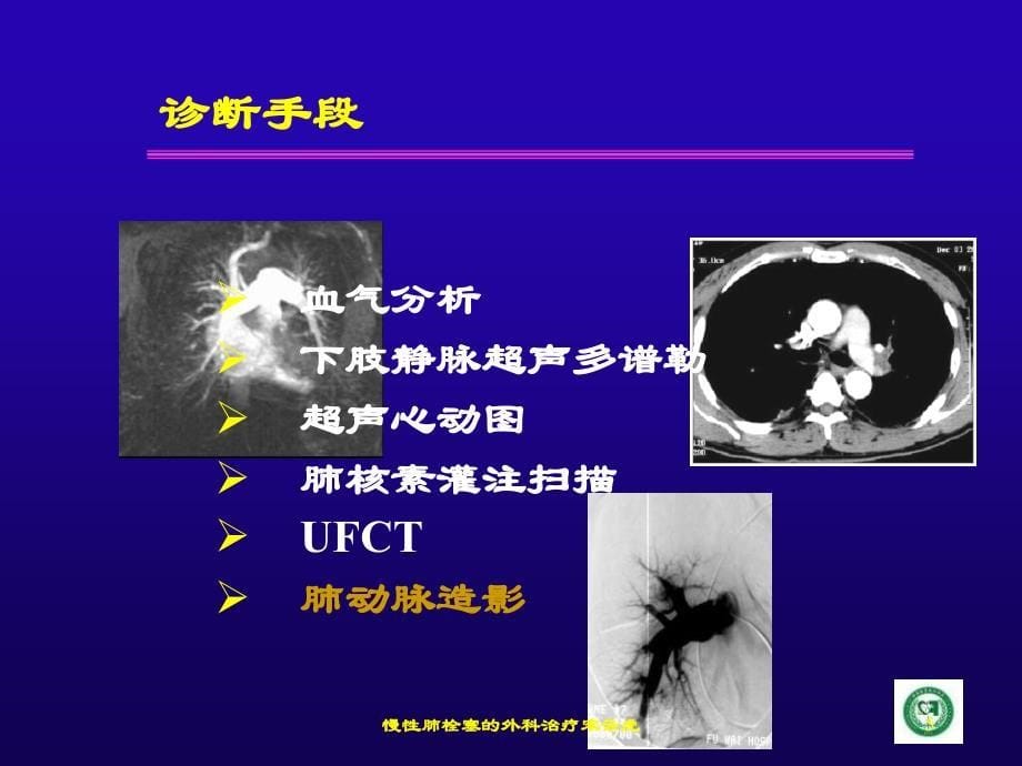 慢性肺栓塞的外科治疗宋云虎课件_第5页