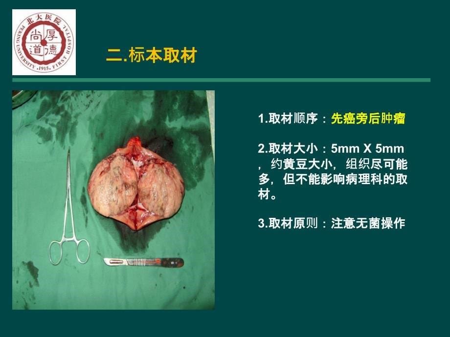 肾癌标本的留取和注意事项_第5页