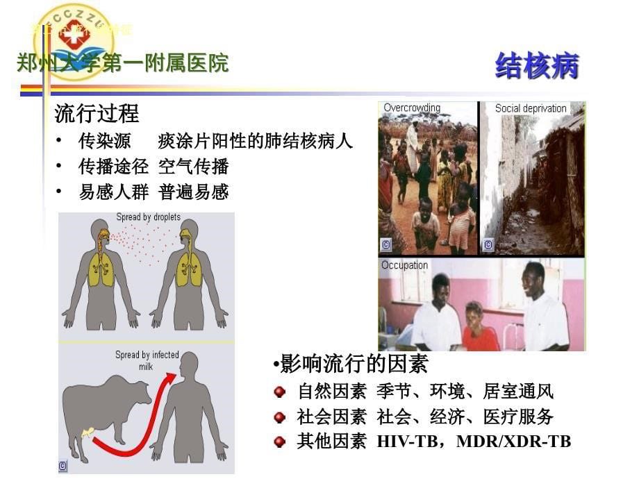 结核分枝杆菌及其实验室诊断新技术_第5页