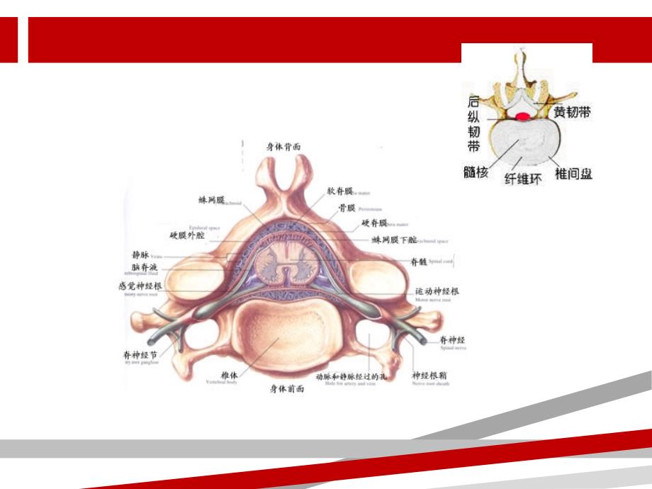 腰椎间盘突出症病人的护理课件_第2页