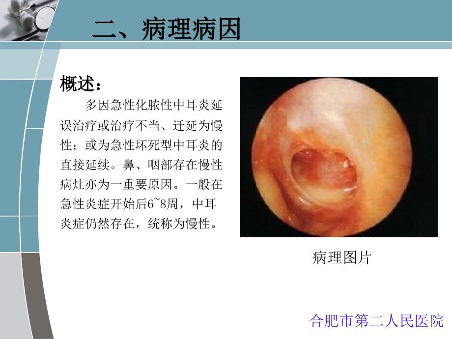 慢性脓性中耳炎qq_第3页