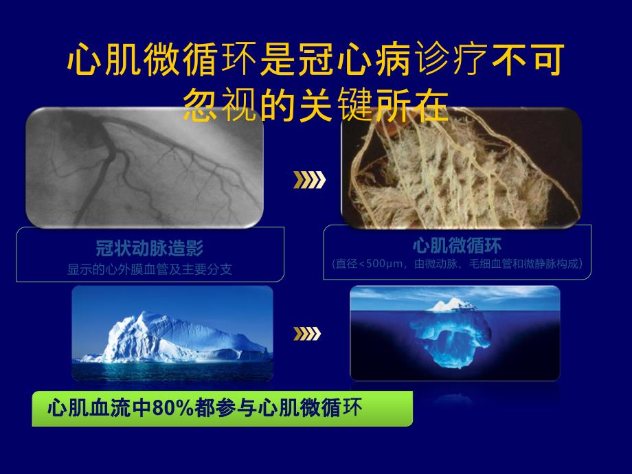 小讲课冠脉微血管病变.ppt_第4页