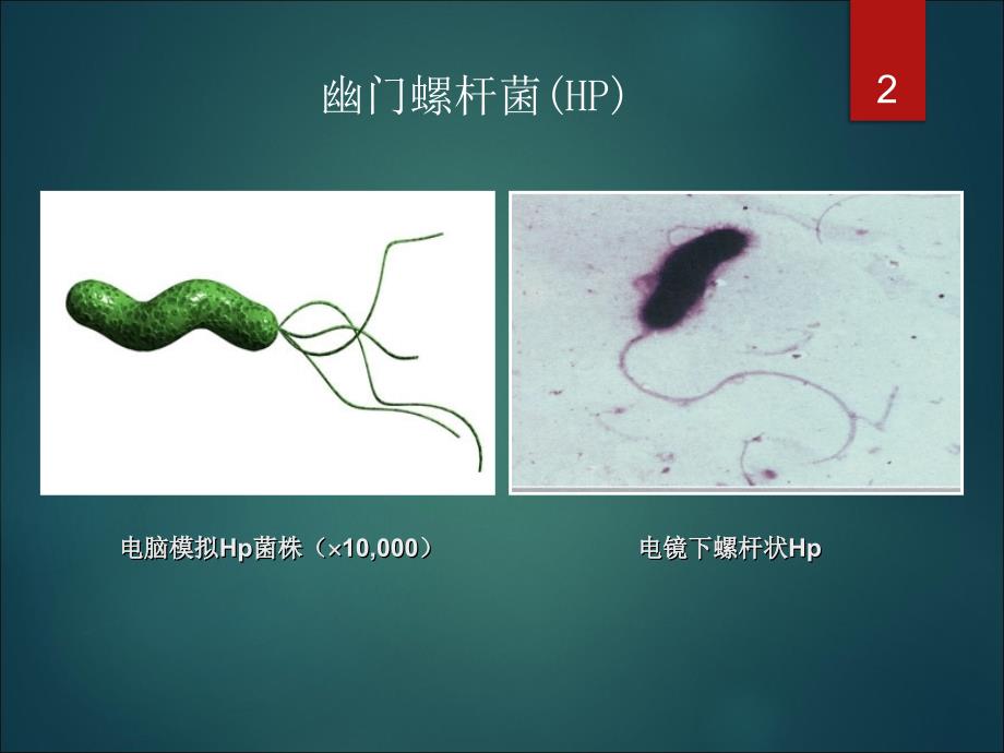 抗HP治疗的方法ppt课件1_第2页