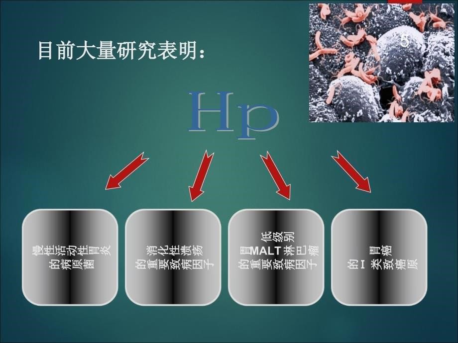 抗HP治疗的方法ppt课件1_第5页