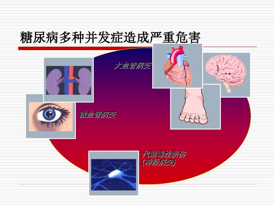 2型糖尿病及口服降糖药物的应用1_第4页