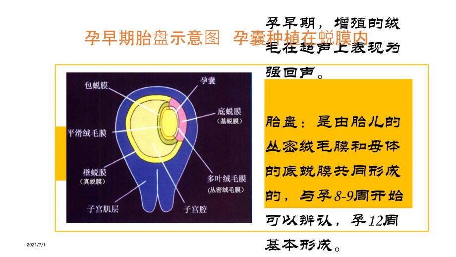 胎盘异常的超声检查_第4页