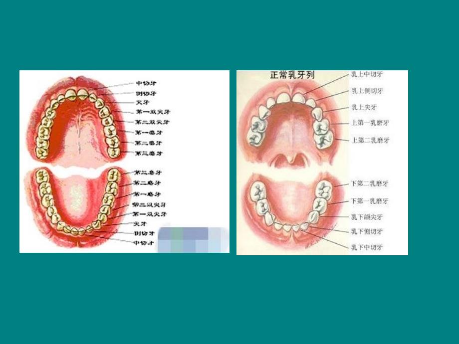 龋齿与牙痛课件_第3页