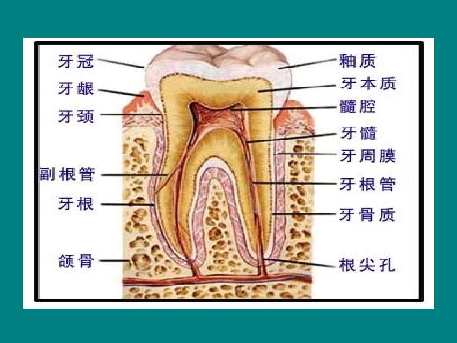 龋齿与牙痛课件_第4页