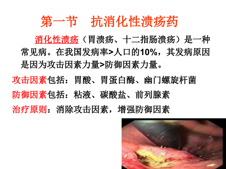 作用于消化系统的药物课件.ppt_第4页