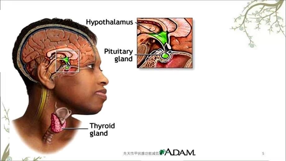 先天性甲状腺功能减低症_第5页