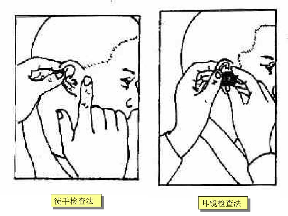 第六篇-第二章-耳的检查课件_第4页