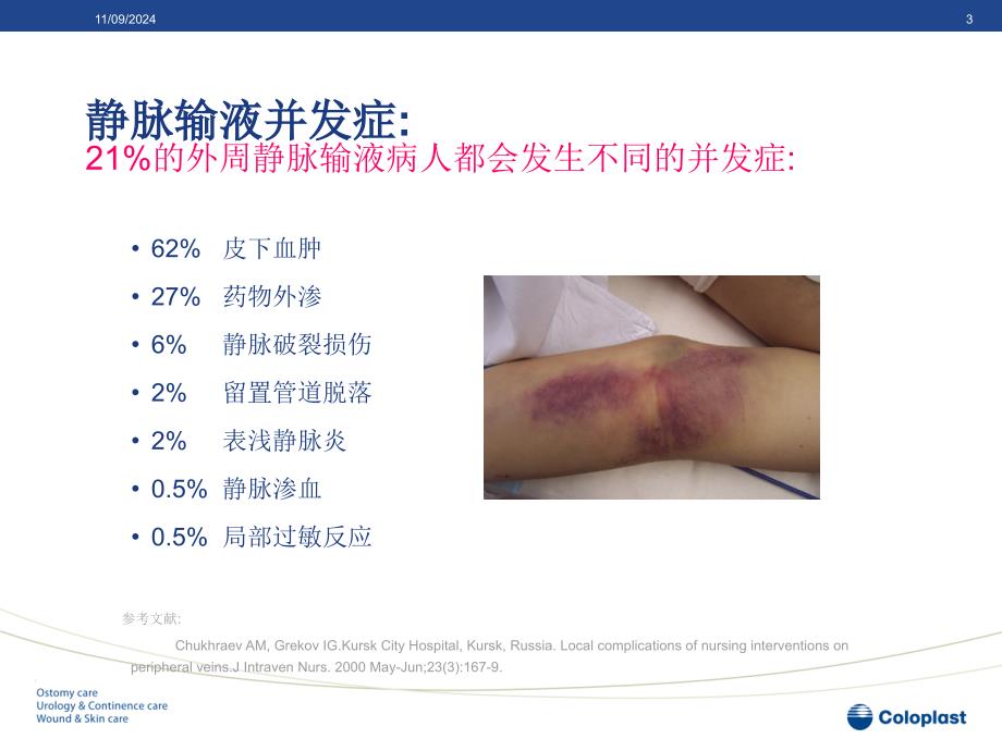 静脉输液的血管保护和周围皮肤护理PowerPoint演示文稿_第3页