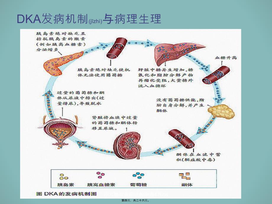 小儿糖尿病酮症酸中毒47666课件_第4页