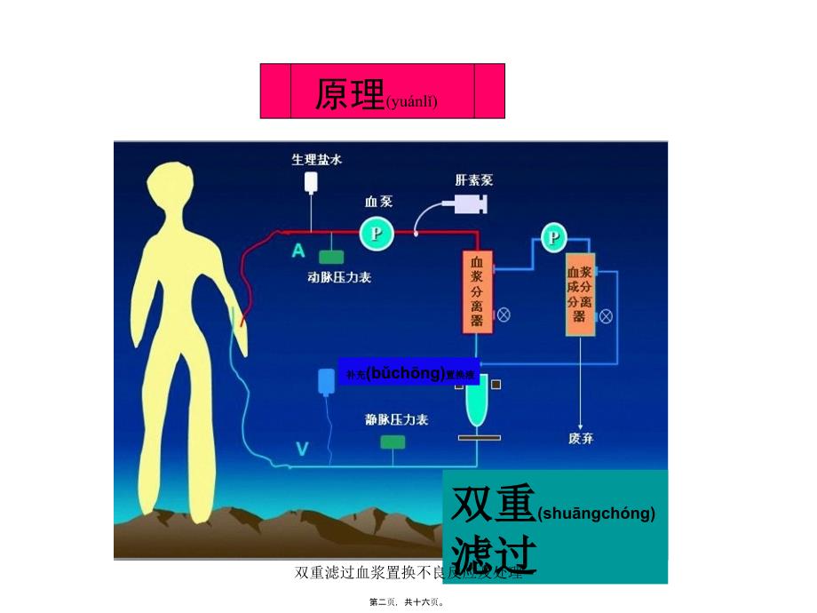 双重滤过血浆置换不良反应及处理课件_第2页