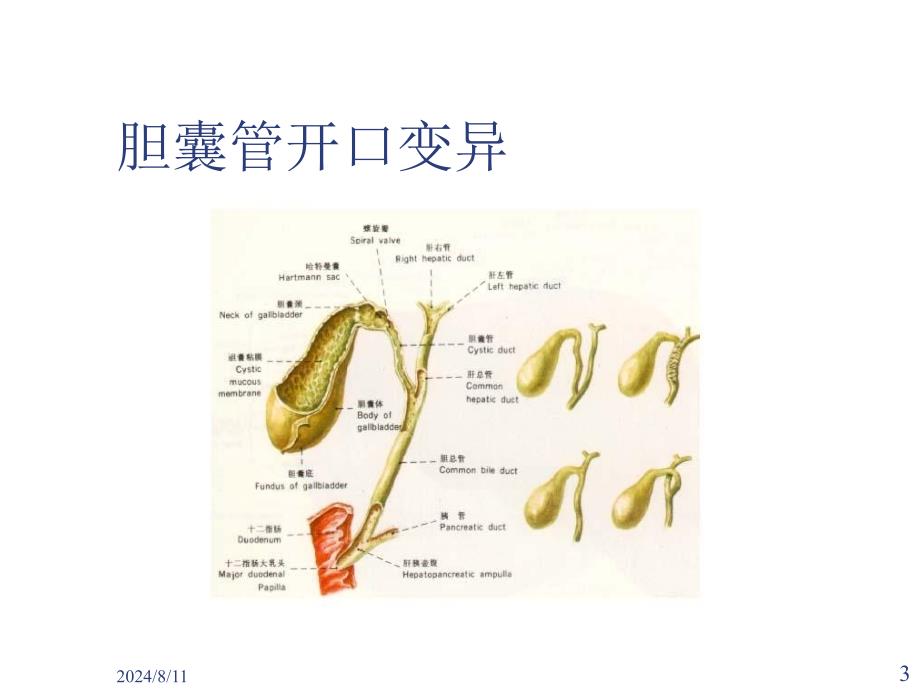 胆囊结石及其防治_第3页