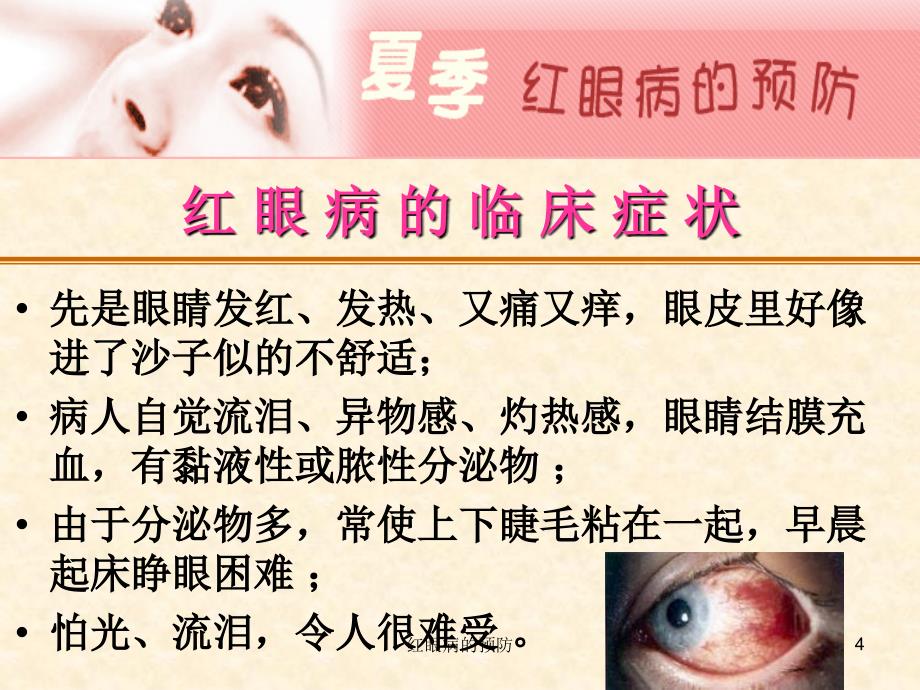 红眼病的预防课件_第4页