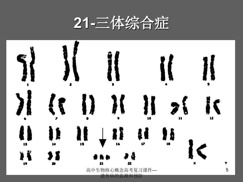 高中生物核心概念高考复习课件遗传病的监测和预防课件_第5页