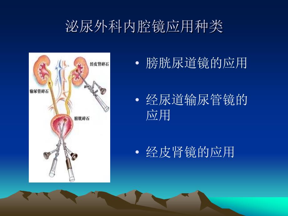 内镜在泌尿外科的应用_第3页