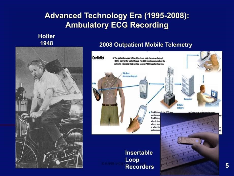 常见缓慢与快速心律失常的处理课件_第5页
