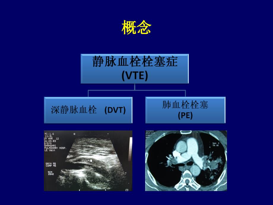 低分子肝素的分类精选PPT_第2页