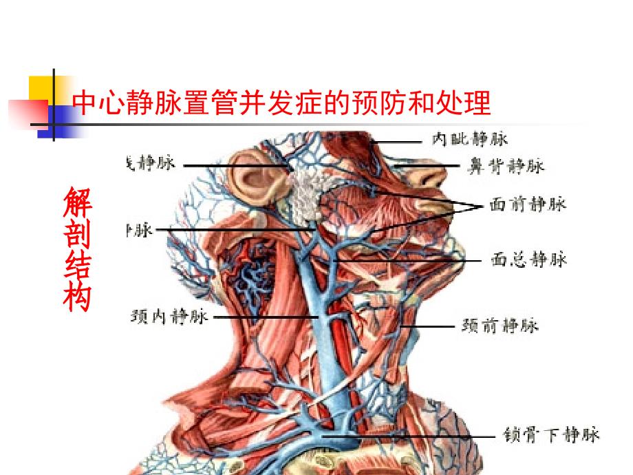 中心静脉置管并发症预防及处理_第3页