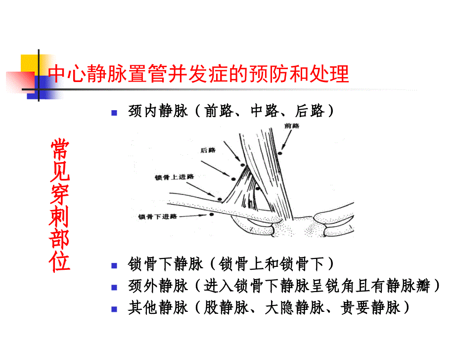 中心静脉置管并发症预防及处理_第4页