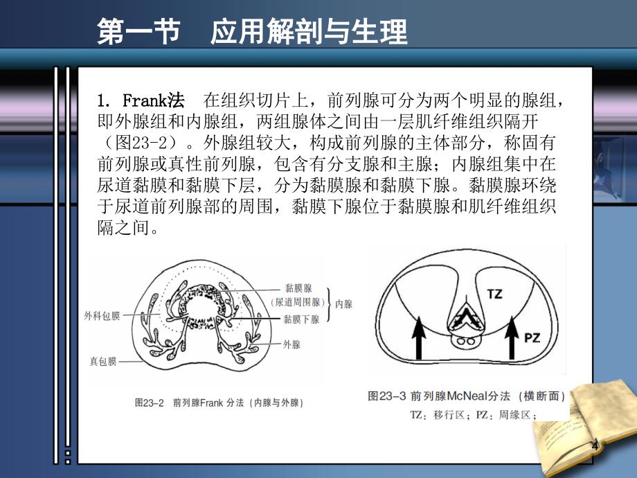 前列腺疾病的超声诊断_第4页