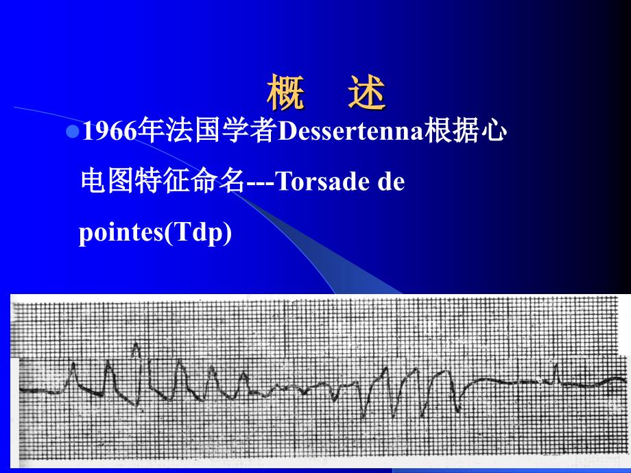 扭转型室性心动过速_第2页