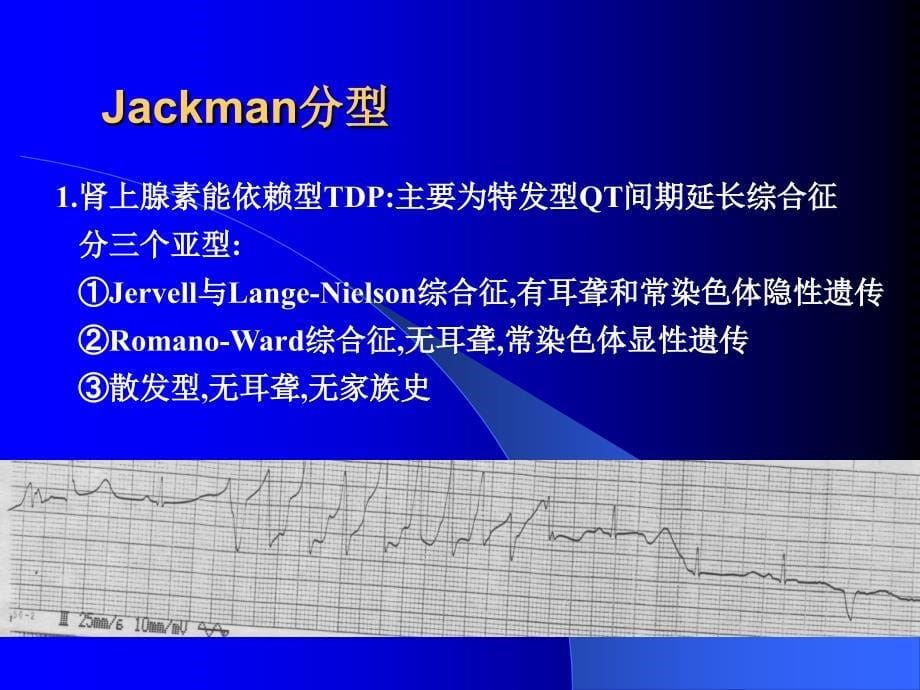 扭转型室性心动过速_第5页